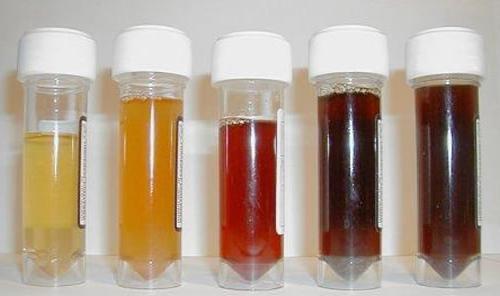 eritrocite crescute în urina copilului