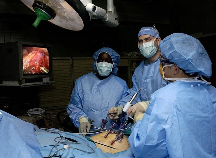 chirurgie laparoscopie